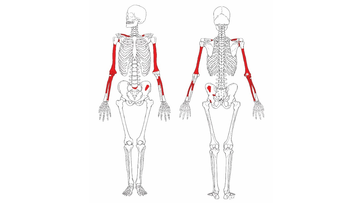 outline of a human skeleton showing which bones of Homo habilis were discovered