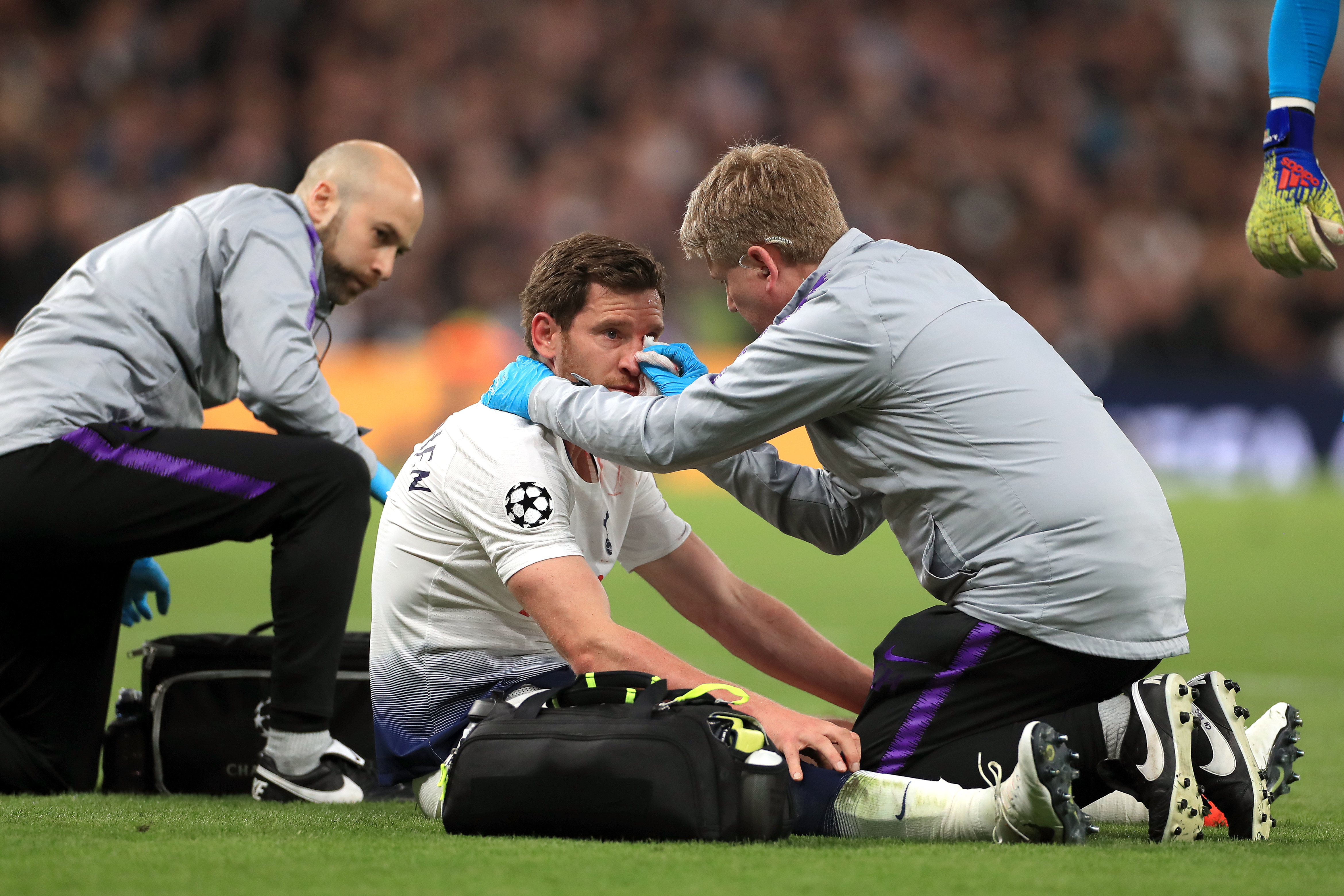 Jan Vertonghen is treated after clashing heads with Toby Alderweireld