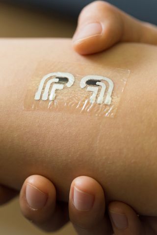 Nanoengineers at the University of California, San Diego, have tested a temporary tattoo that both extracts and measures the level of glucose in the fluid in between skin cells.