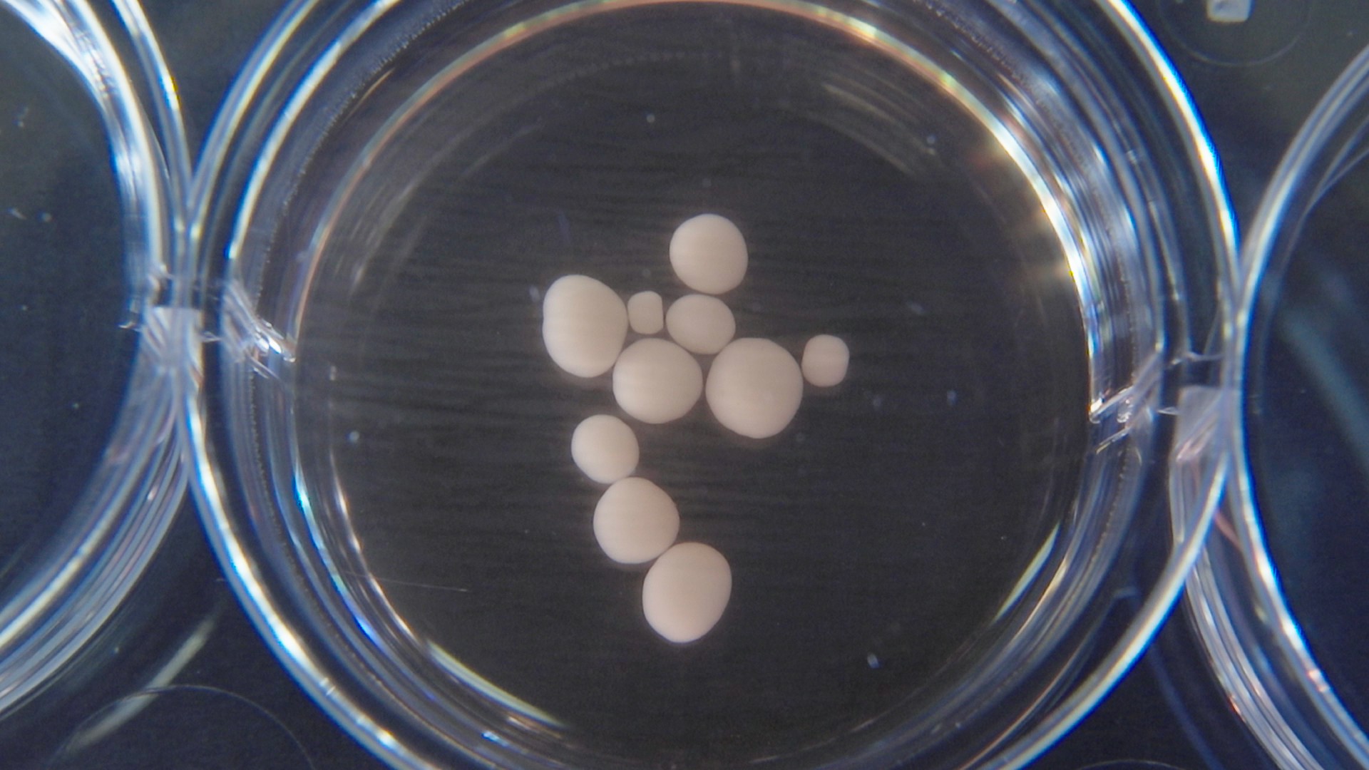 Image of brain organoids in a petri dish. The organoids are spherical and a cream color. There are 10 of them and they are all different sizes.