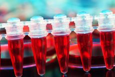 Stem cell transplant.