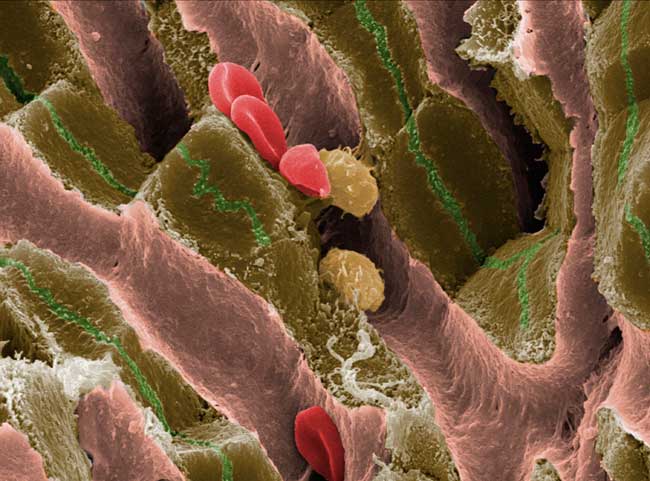 This image of the liver shows blood vessels called sinusoids as long pink channels, brown tissue that is important in the production of bile. The channels - shown as thin green grooves - carry the bile towards the small intestine to help digestion. This i