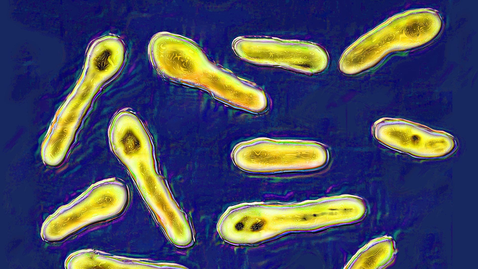 bright yellow, club-shaped bacterial cells against a blue background