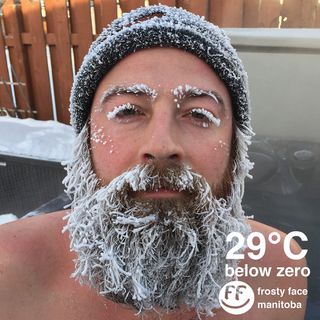 Beard, mustache, eyebrows and eyelashes on this Manitoba "frosty face" are liberally coated in ice, at a temperature of minus 20 degrees F (minus 29 degrees C).