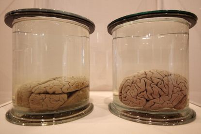 100 missing brains found in Texas