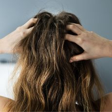 woman scratching her head - hairline psoriasis