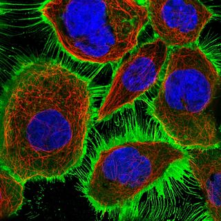 An image of a protein called EGFR (epidermal growth factor receptor) in human cells viewed under a microscope. EGFR, which is shown in green, is localized to the cell's membrane. The cell's nucleus is shown in blue.