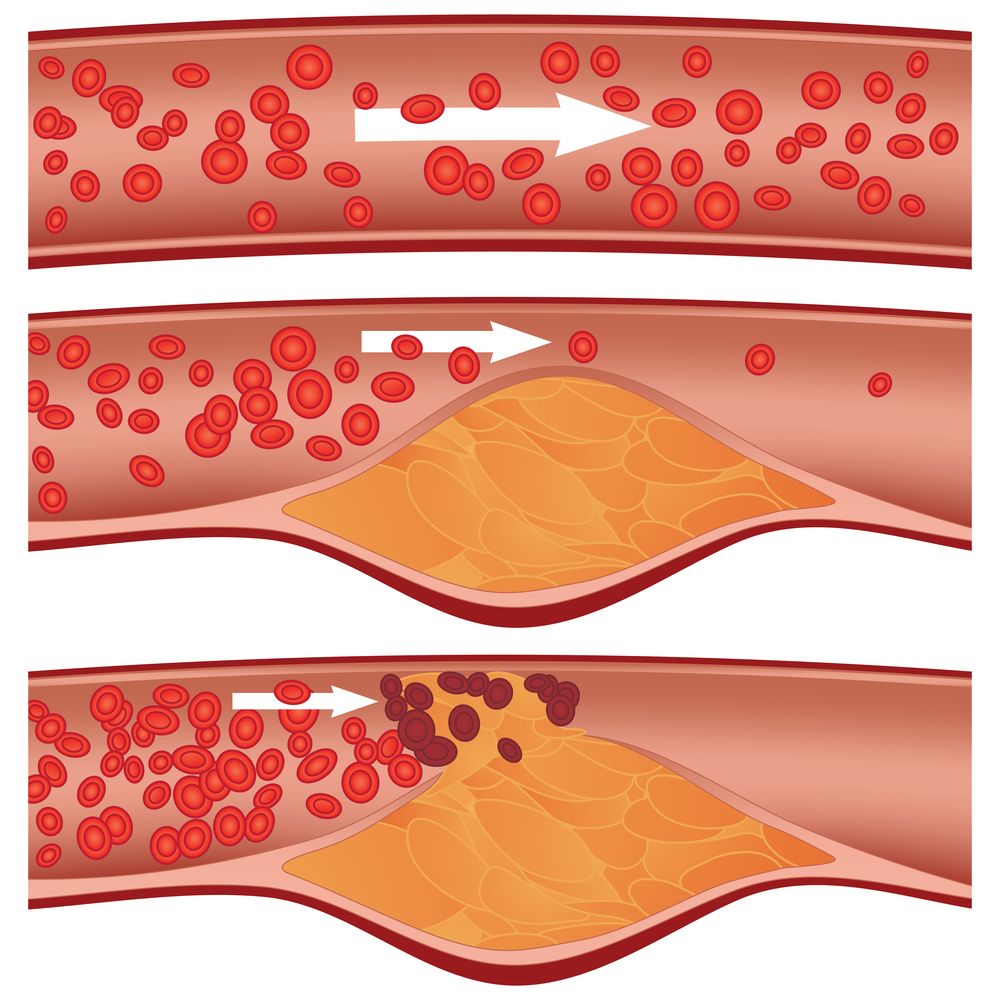 Blood circulation and cholesterol
