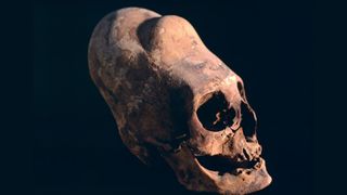 A close up of a brown skull with a conical forehead from head shaping procedures. 