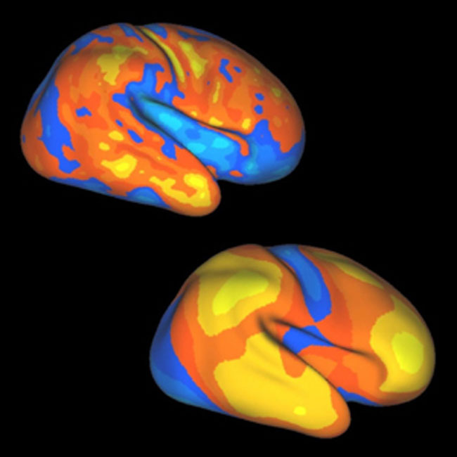 Baby Brain Growth Reflects Human Evolution | Live Science