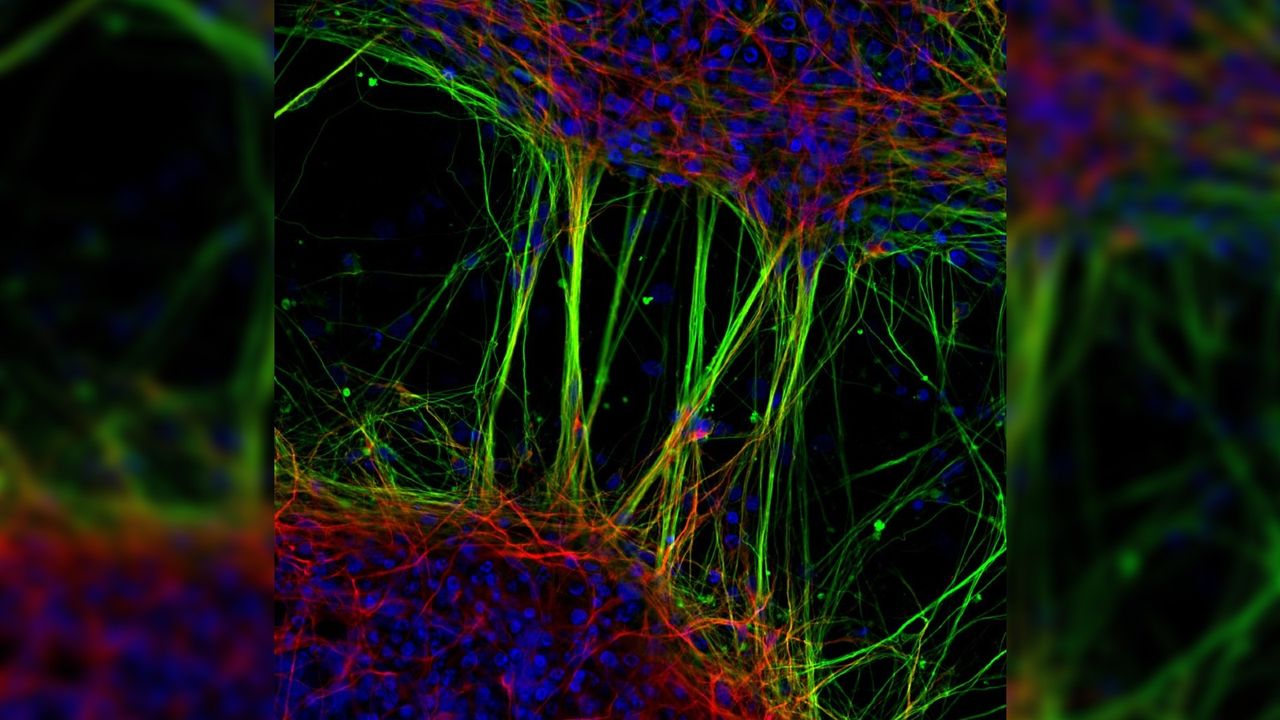 A network of human neurons that were cultivated from stem cells.