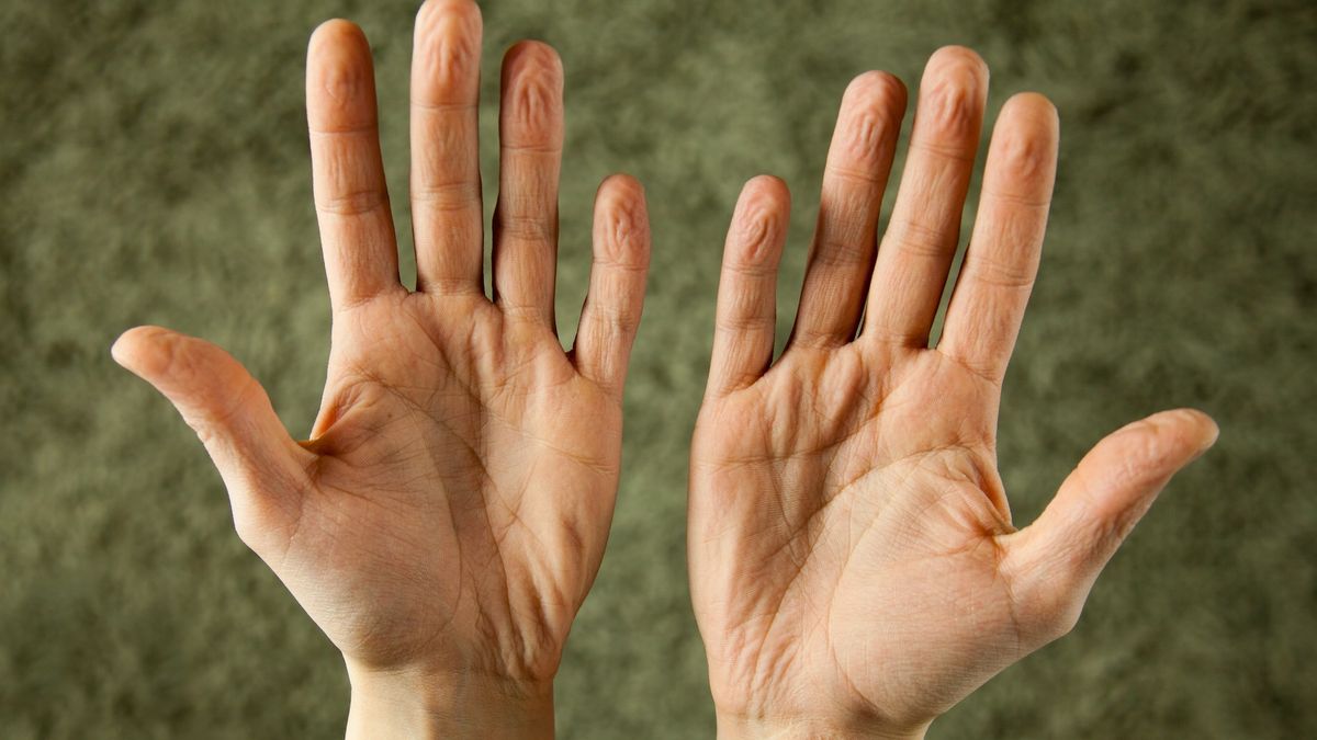 Your fingers 'prune' the exact same way each time, study suggests