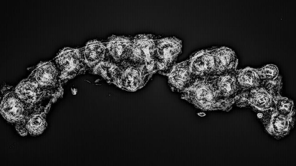 Black-and-white X-ray image of an ancient Roman sandal.