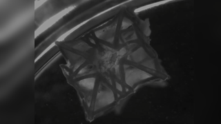 3D Printed Heart Patch