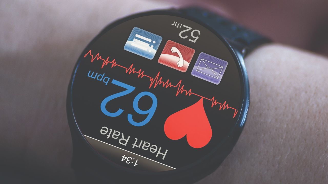 Picture of a smart watch