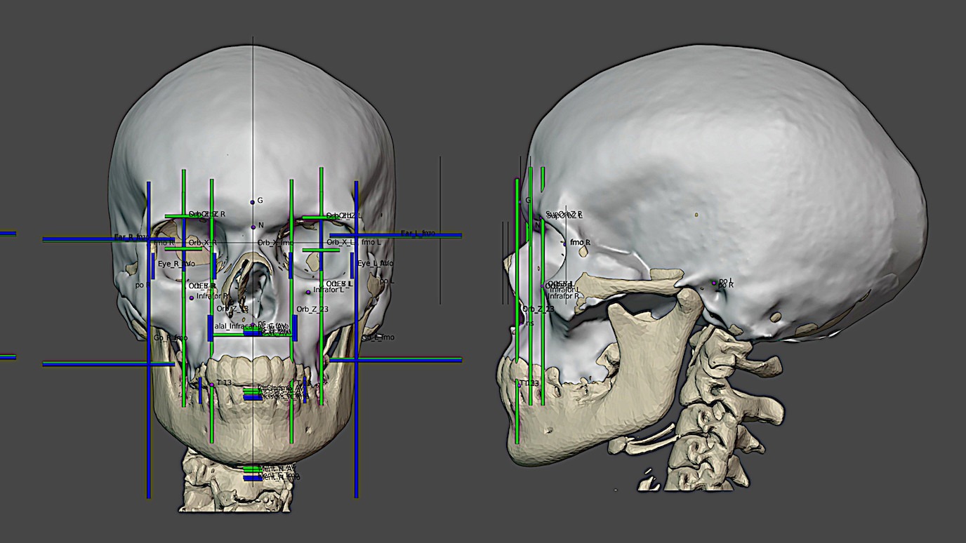 A digitized version of the 31,000-year-old skull seen from two angles.