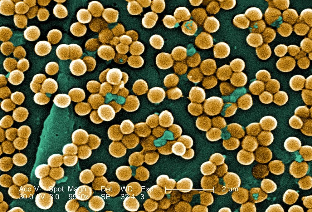 Distinguishing Deadly Staph Bacteria from Harmless Strains