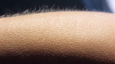 Goosebumps cover a person's arm.