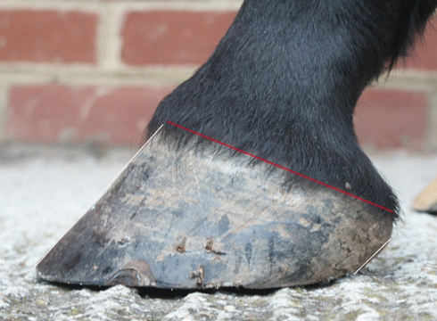 Normal foot