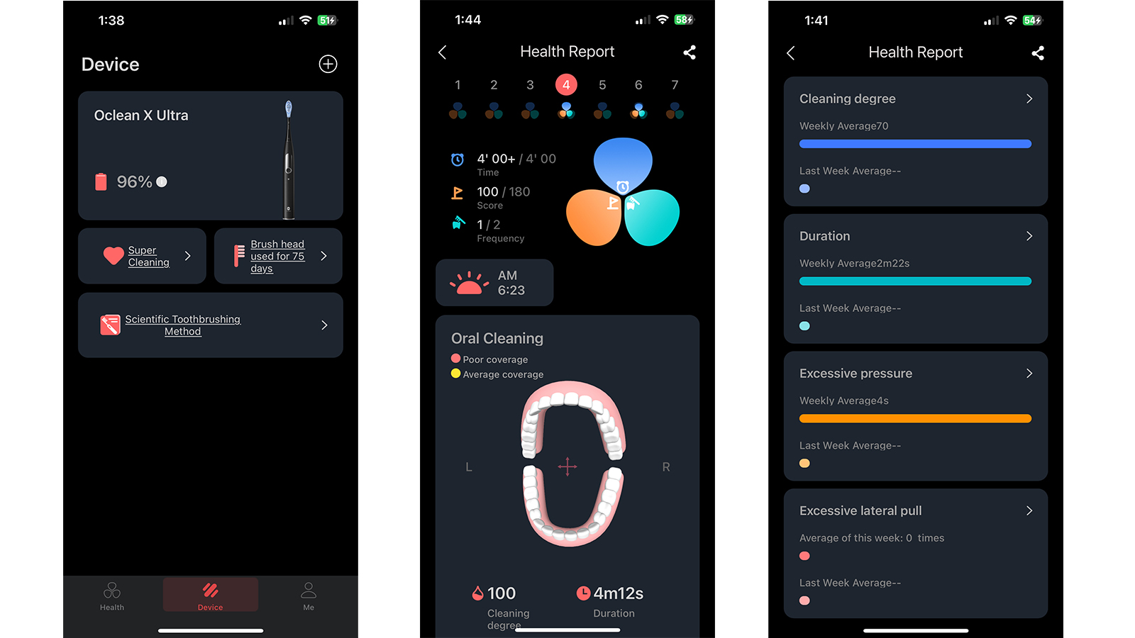 Capturas de pantalla de la aplicación Oclean Care+ que muestran datos de cepillado y cepillado