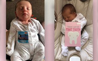 Isla-Rose Heasman had her natal tooth pulled out when she was just 12 days old.