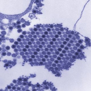 This image shows magnified particles of the Chikungunya virus, which is spread by mosquitos. The virus was found in the Americas, on islands in the Caribbean, for the first time in late 2013.