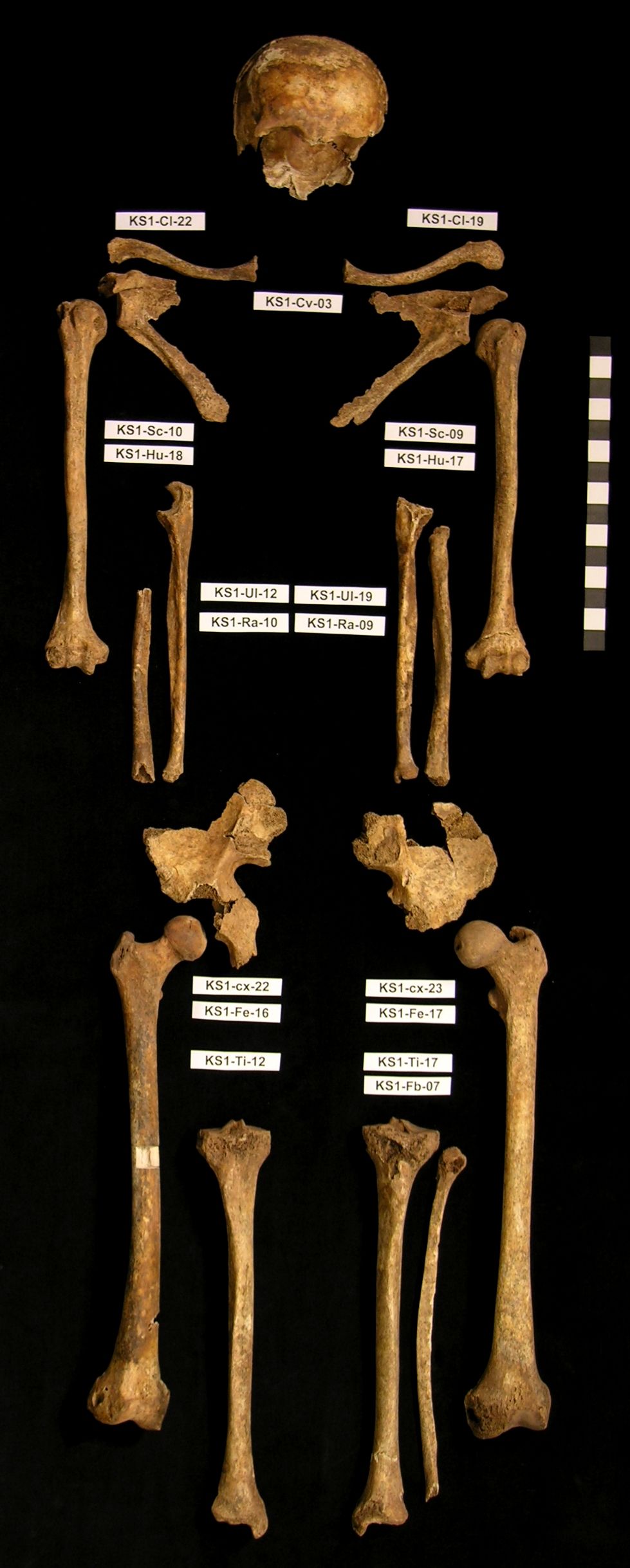 Skeletal remains from mass grave in Kassel, Germany.