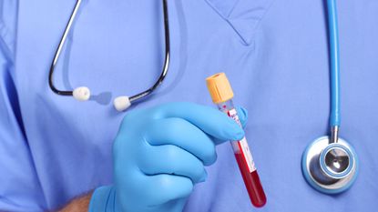 doctor holding blood in test tube