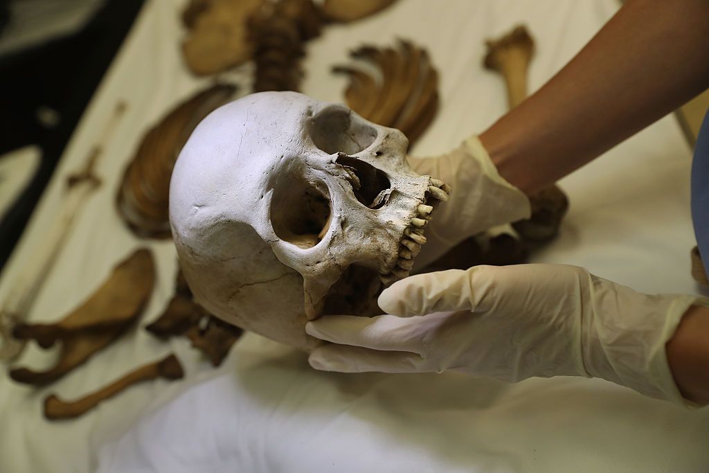 Woman holding skull.