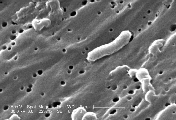 Cholera bacteria