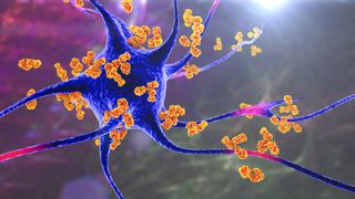 Concept art of antibodies attacking a neuron, as is the case with certain autoimmune diseases.