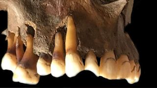 close up of a jawbone and teeth from the remains of a young adult male excavated in Holland who died in the 1600s