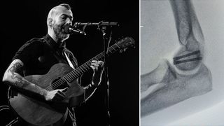 British precussive acoustic guitar player Jon Gomm