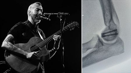 British precussive acoustic guitar player Jon Gomm