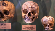 Three skulls are shown in a museum exhibit. They all have pock-marks on their frontal bones. There are two signs that label them as people who had tertiary syphilis.