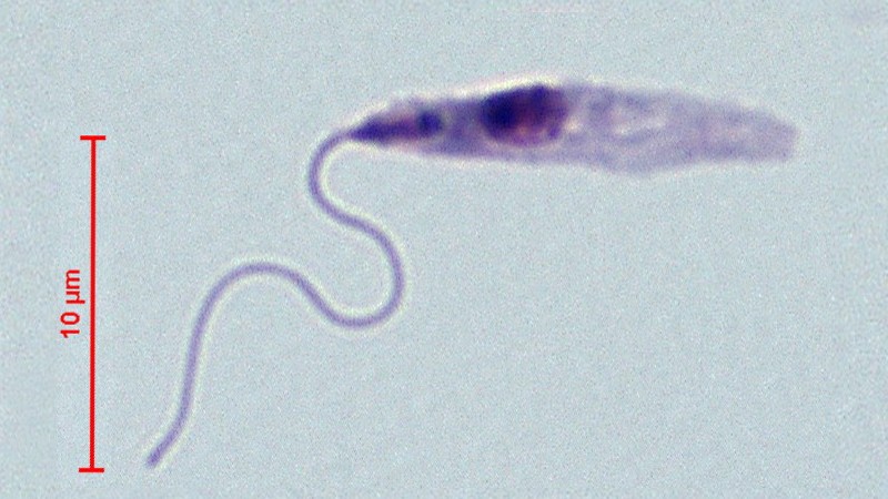 A photo of Trypanosoma brucei gambiense, a type of parasite that causes the infection leishmaniasis.