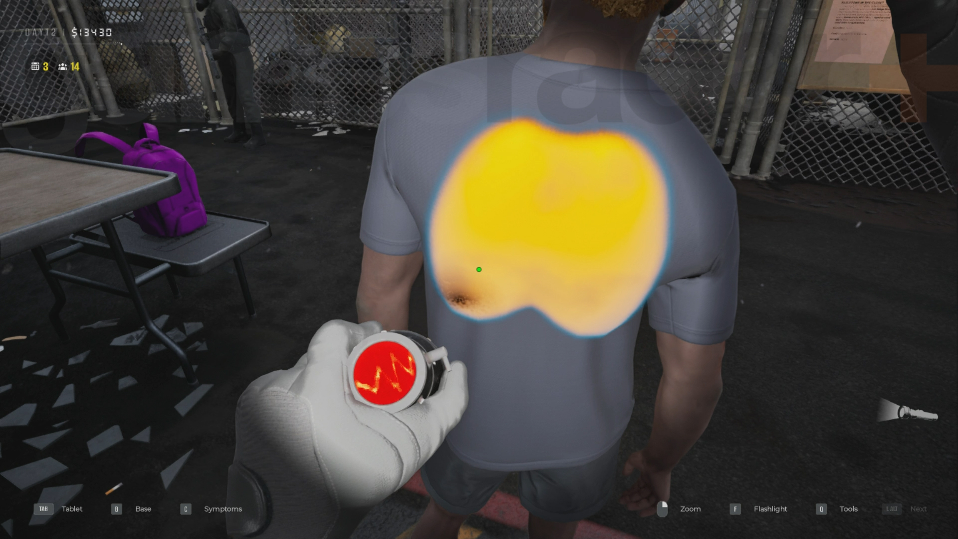 Diagnosing Quarantine Zone symptoms using the stethoscope