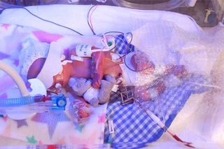 This photograph shows a premature baby surrounded by medical equipment and a teddy. The photograph serves to illustrate that even with the veritable arsenal of complex equipment surrounding this very small and vulnerable child, there is still a very impor