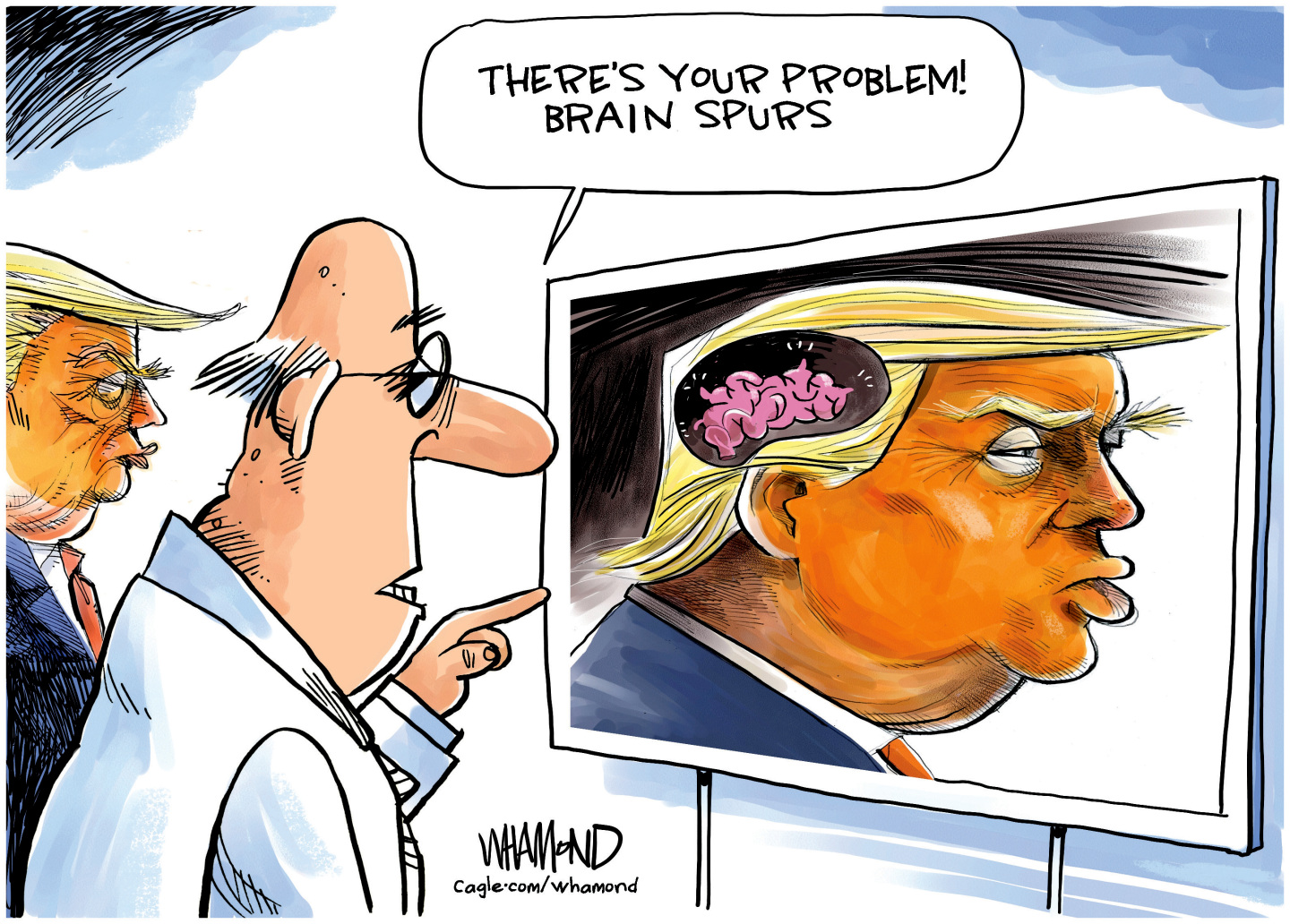 Donald Trump and a male medical doctor look at a screen showing a side view of Trump&amp;rsquo;s brain. The doctor points at it and says, &amp;ldquo;There&amp;rsquo;s your problem! Brain spurs.&amp;rdquo;