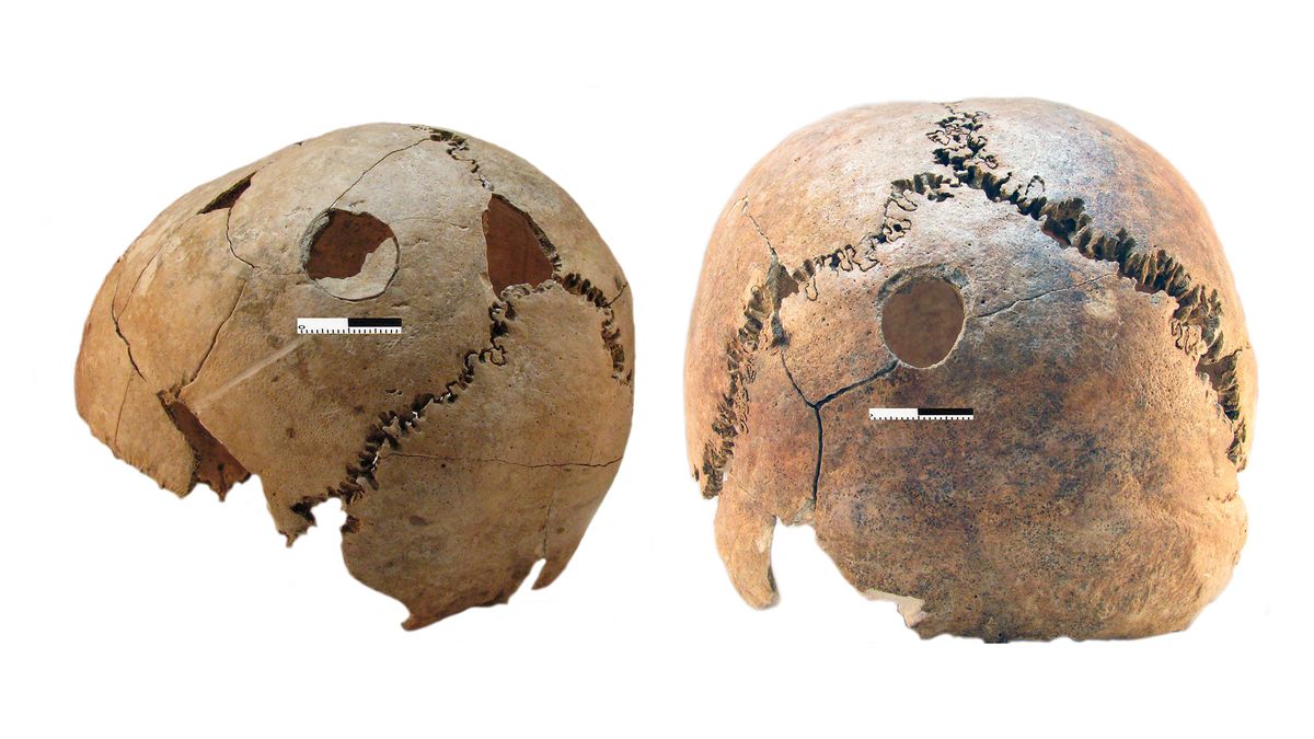 Why were dozens of people slaughtered 6,200 years ago and buried in a Neolithic death pit?