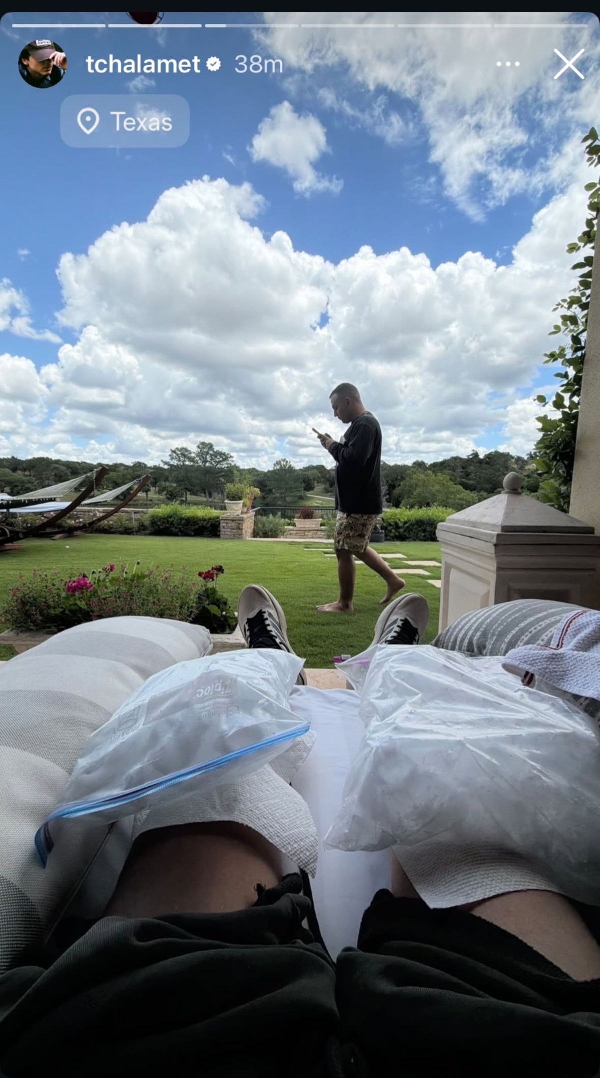 Timoth&eacute;e Chalamet icing both his knees while looking out at a nice yard.