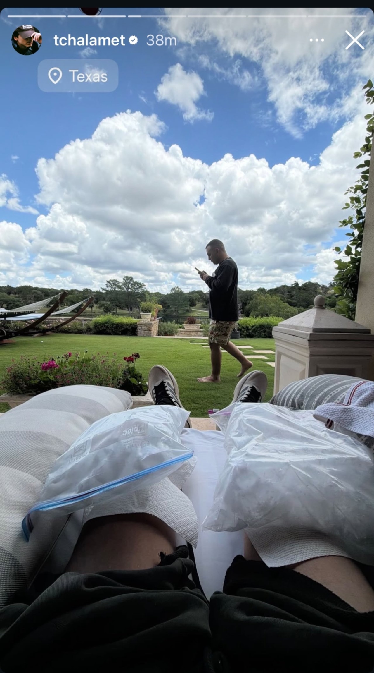 Timoth&eacute;e Chalamet icing both his knees while looking out at a nice yard. 
