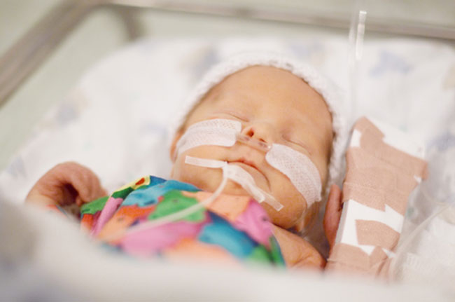 Premature Births Remain a Medical Mystery | Live Science