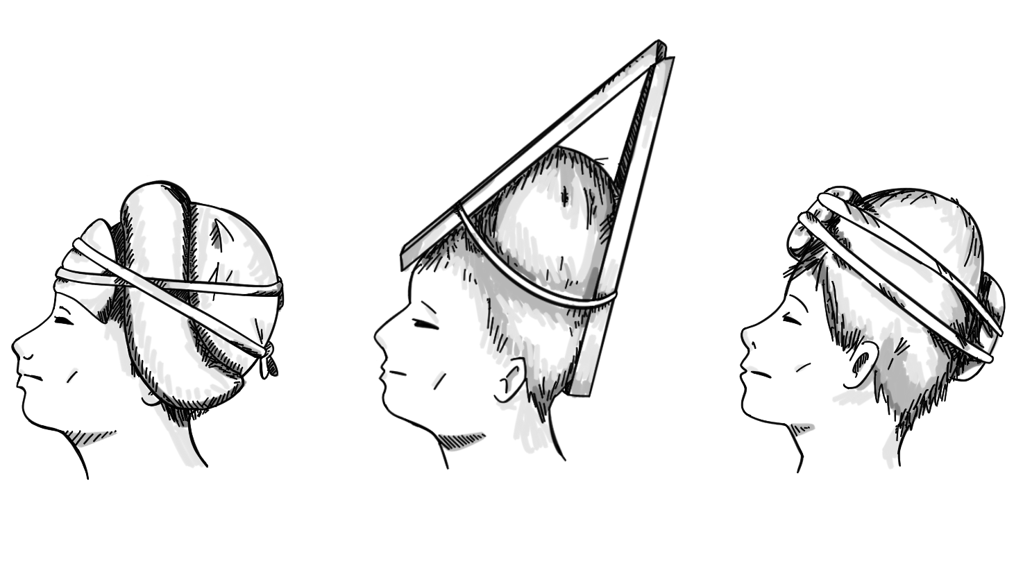 three line drawings of children wearing head-shaping devices