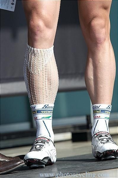 Kris Boeckmans still showing some scars from the early season of racing