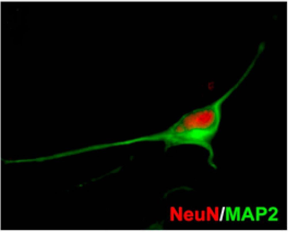 brain cells, skin cells, stem cells, embryonic, adult stem cells, induced pleuripotent stem cells, alzheimer&#039;s, neurodegenerative diseases, brain, memory