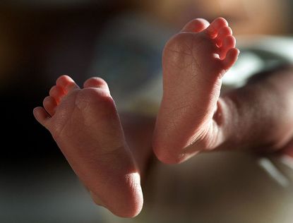 A baby boy is the first to have DNA from 3 parents.