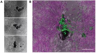 A figure from a scientific paper showing green fibers on top of the fibers of a neuron