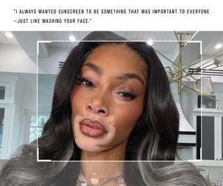 Kein Filter mit Winnie Harlow