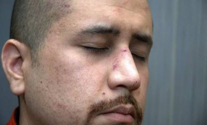 This Feb. 27 photo released by the Florida State Attorney's Office shows George Zimmerman, who shot and killed Trayvon Martin, with injuries to his nose. The photograph was among a trove of e